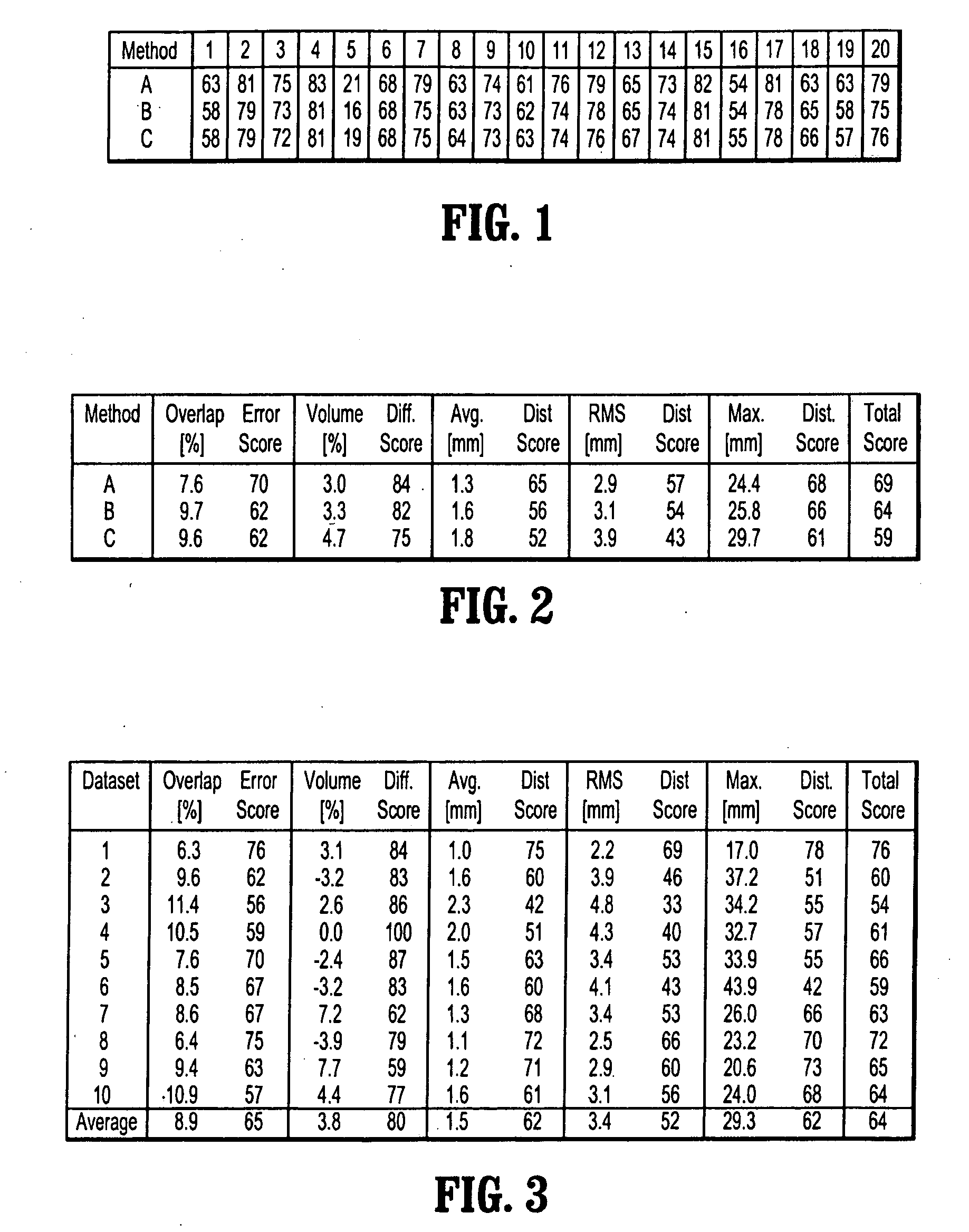 System and method for global-to-local shape matching for automatic liver segmentation in medical imaging