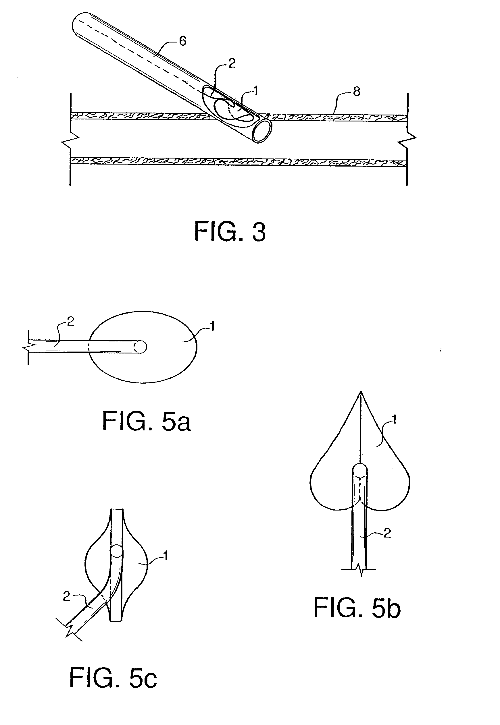 Sealing device