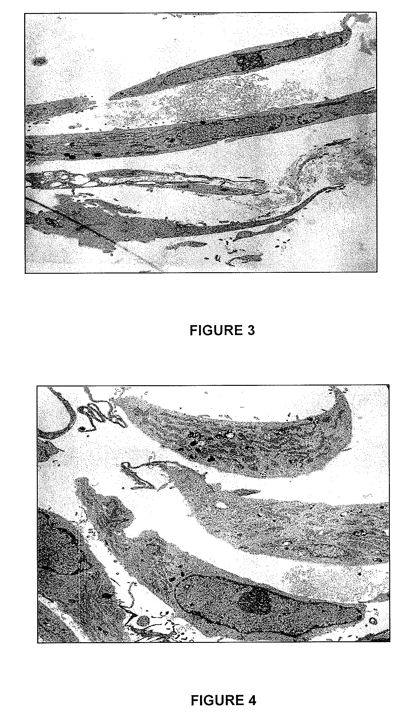 Disaccharides for the treatment of tendons, ligaments, and bones