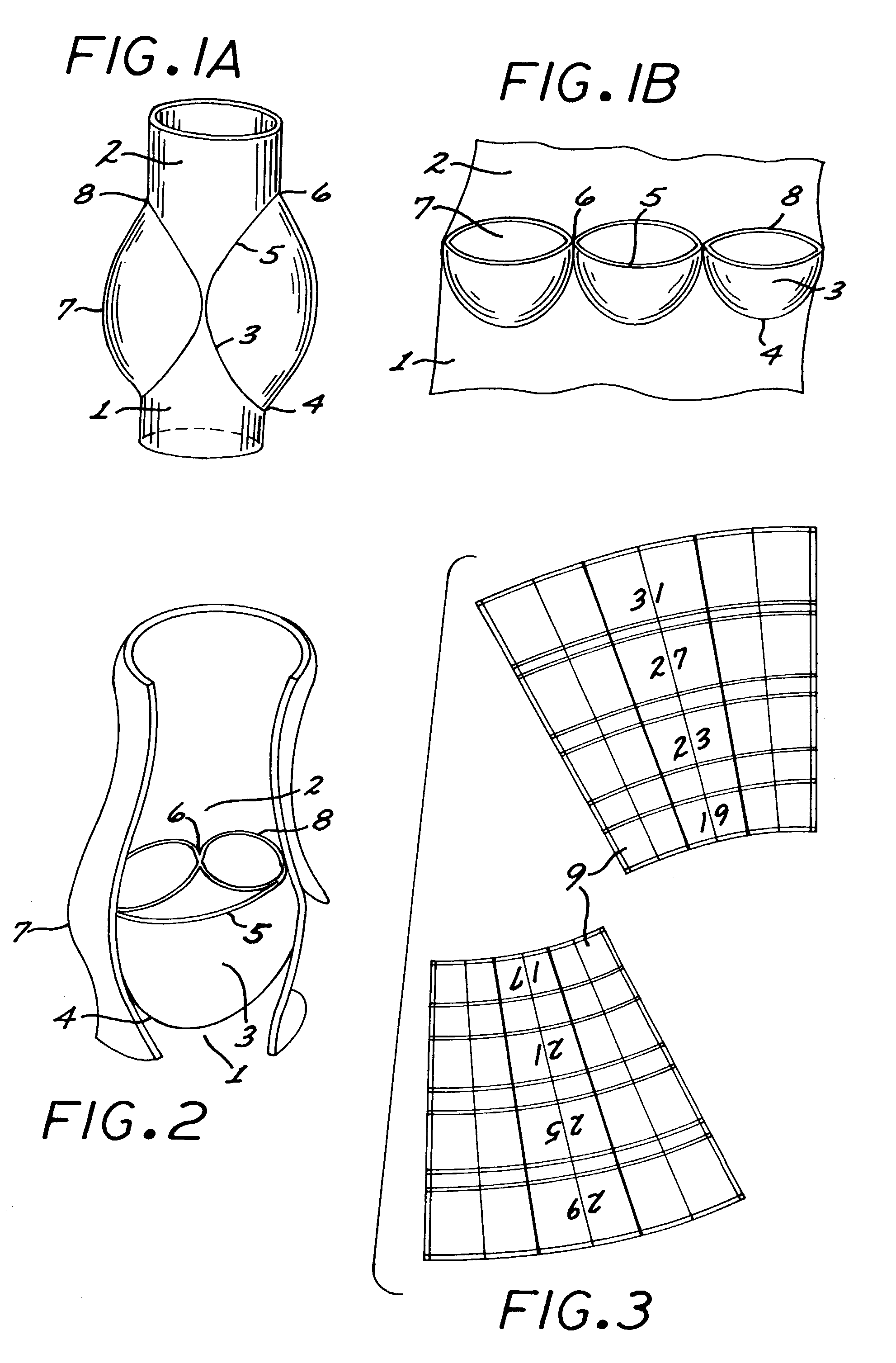 Reed valve for implantation into mammalian blood vessels and heart with optional temporary or permanent support