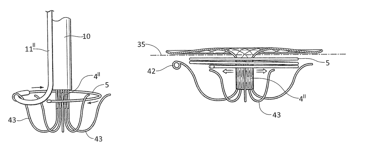 Devices, systems and methods for delivering a prosthetic mitral valve and anchoring device