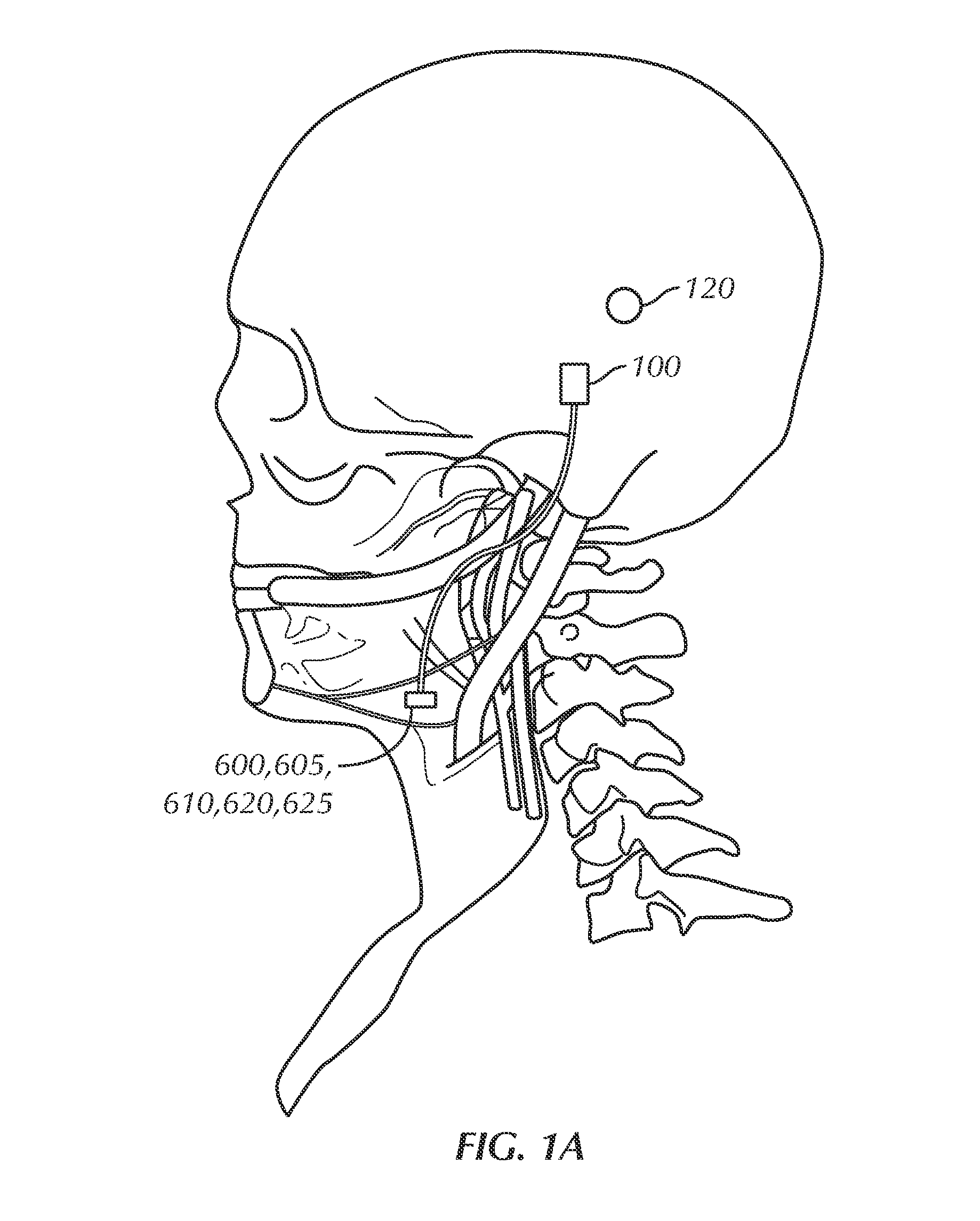 Apparatus, system and method for selective stimulation