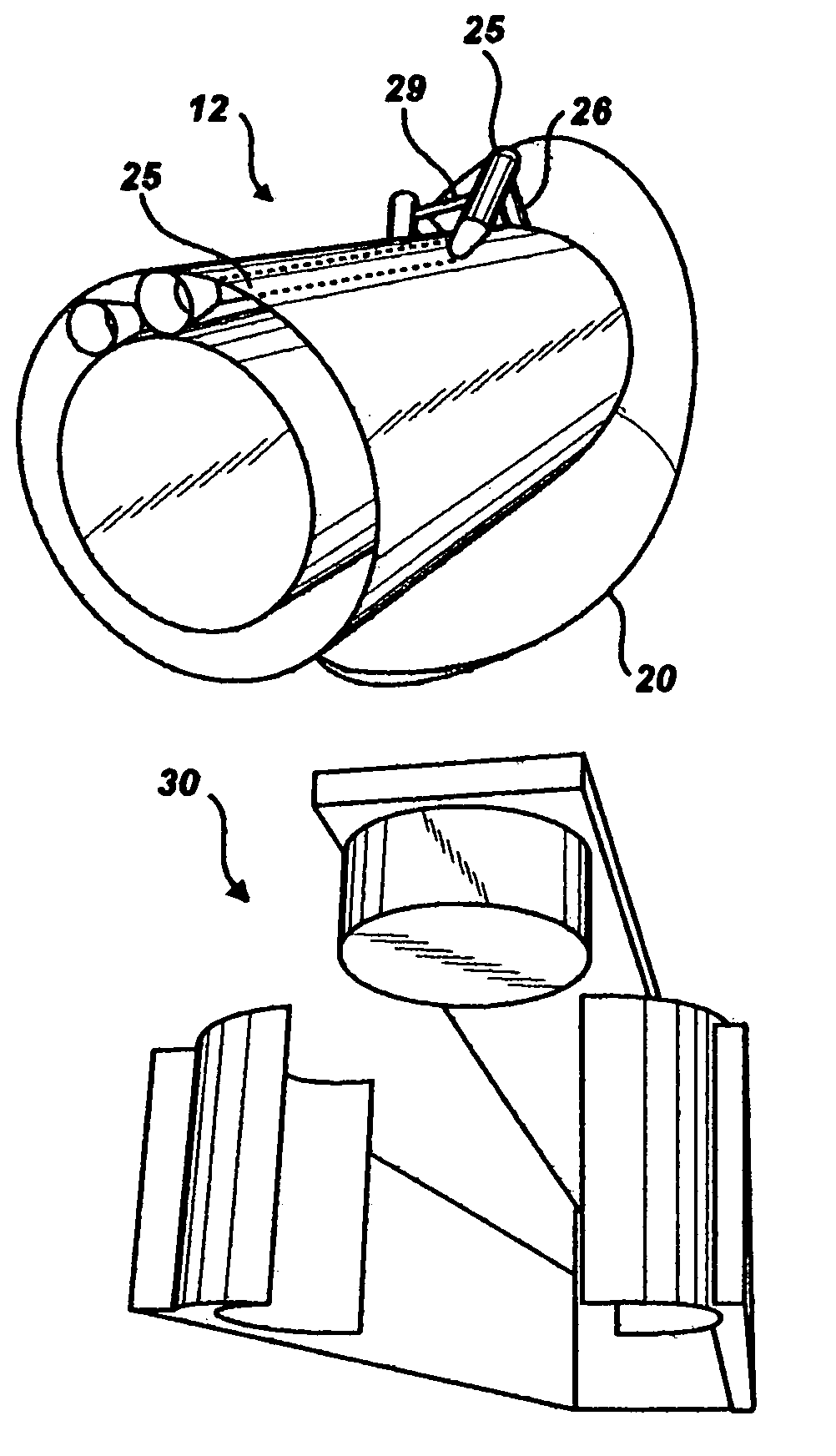 Graft core for seal and suture anastomoses with devices and methods for percutaneous intraluminal excisional surgery (PIES)