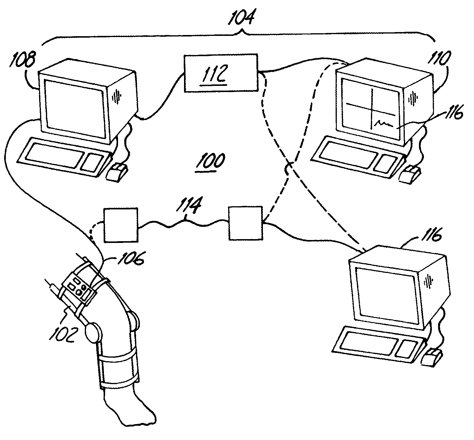 Remote monitoring of an instrumented orthosis