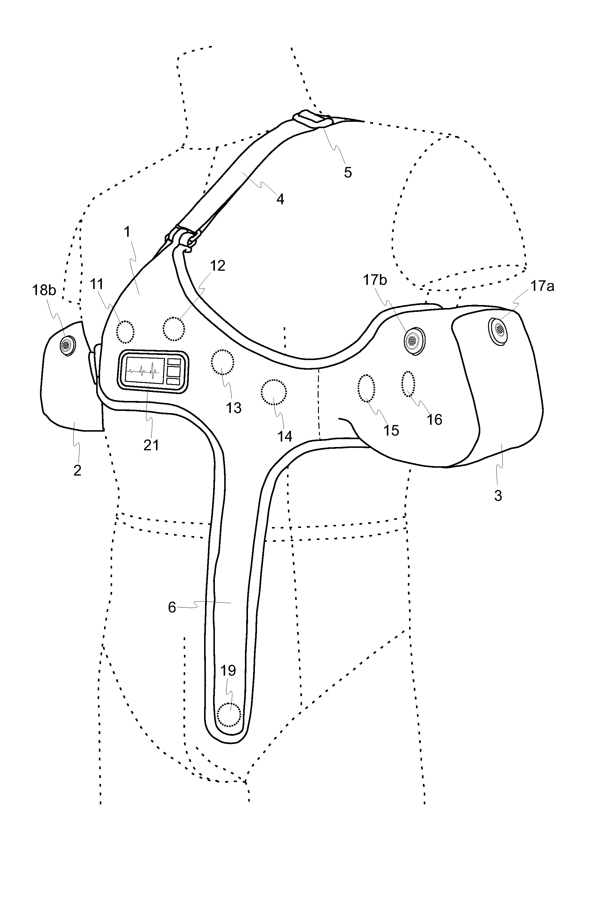 Wearable for acquisition of resting multi-lead ECG