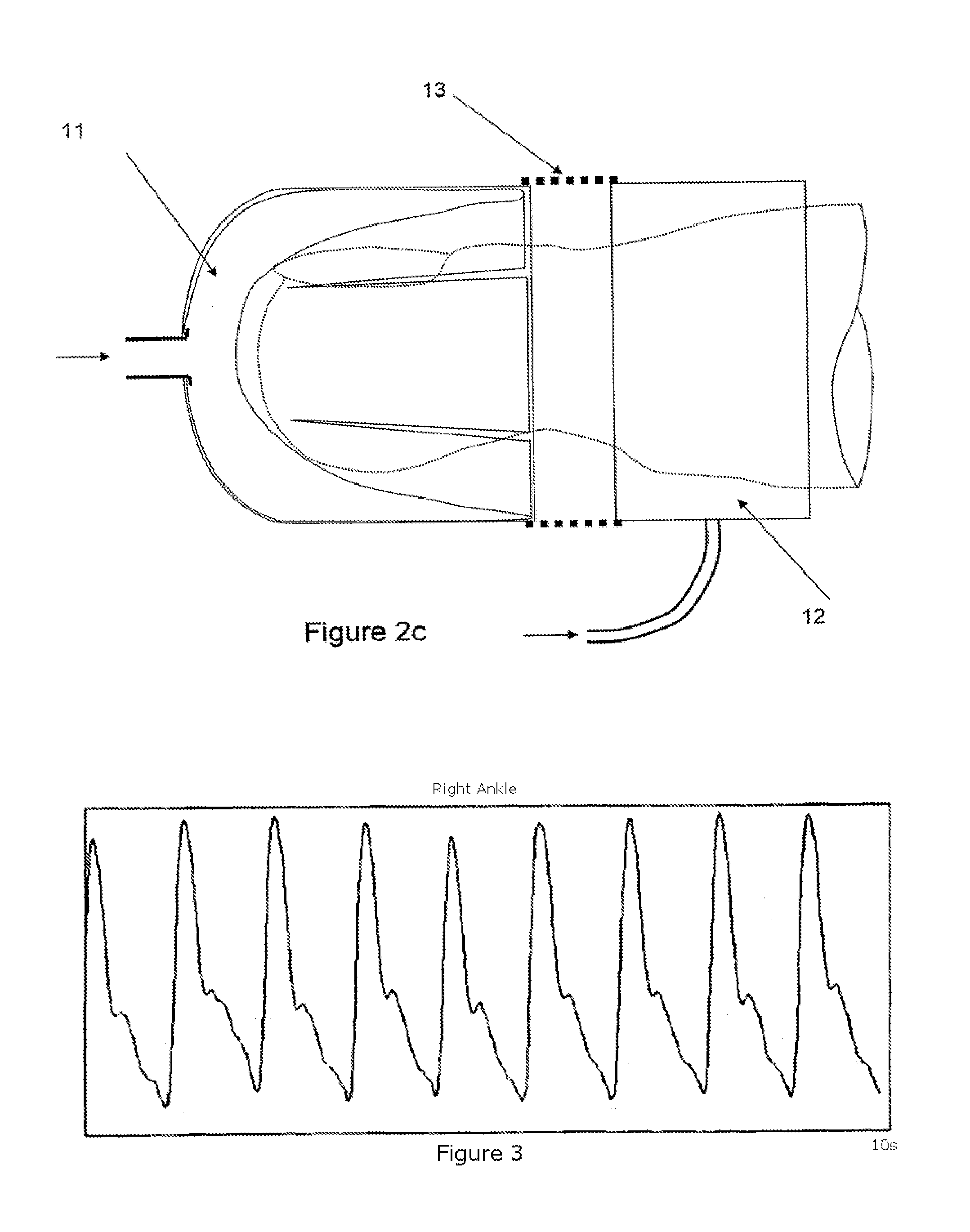 Automatic ankle brachial pressure index system