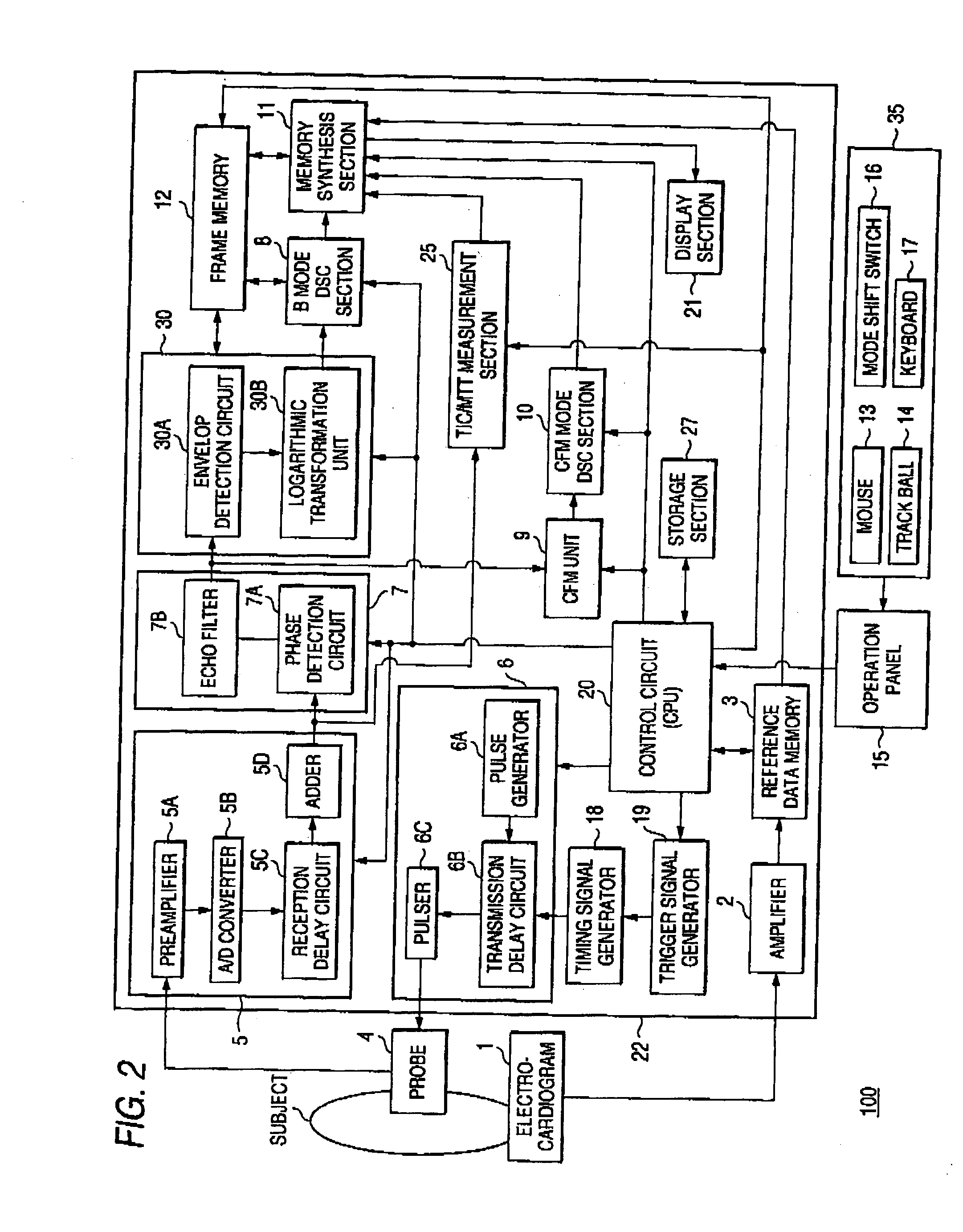 Ultrasonic diagnostic apparatus