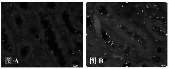 Method for perfusion fixation of whole-body tissue of mouse