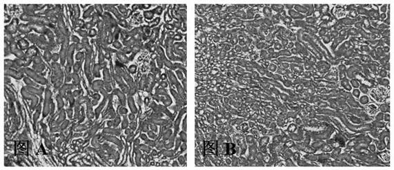 Method for perfusion fixation of whole-body tissue of mouse