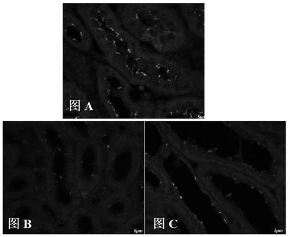 Method for perfusion fixation of whole-body tissue of mouse