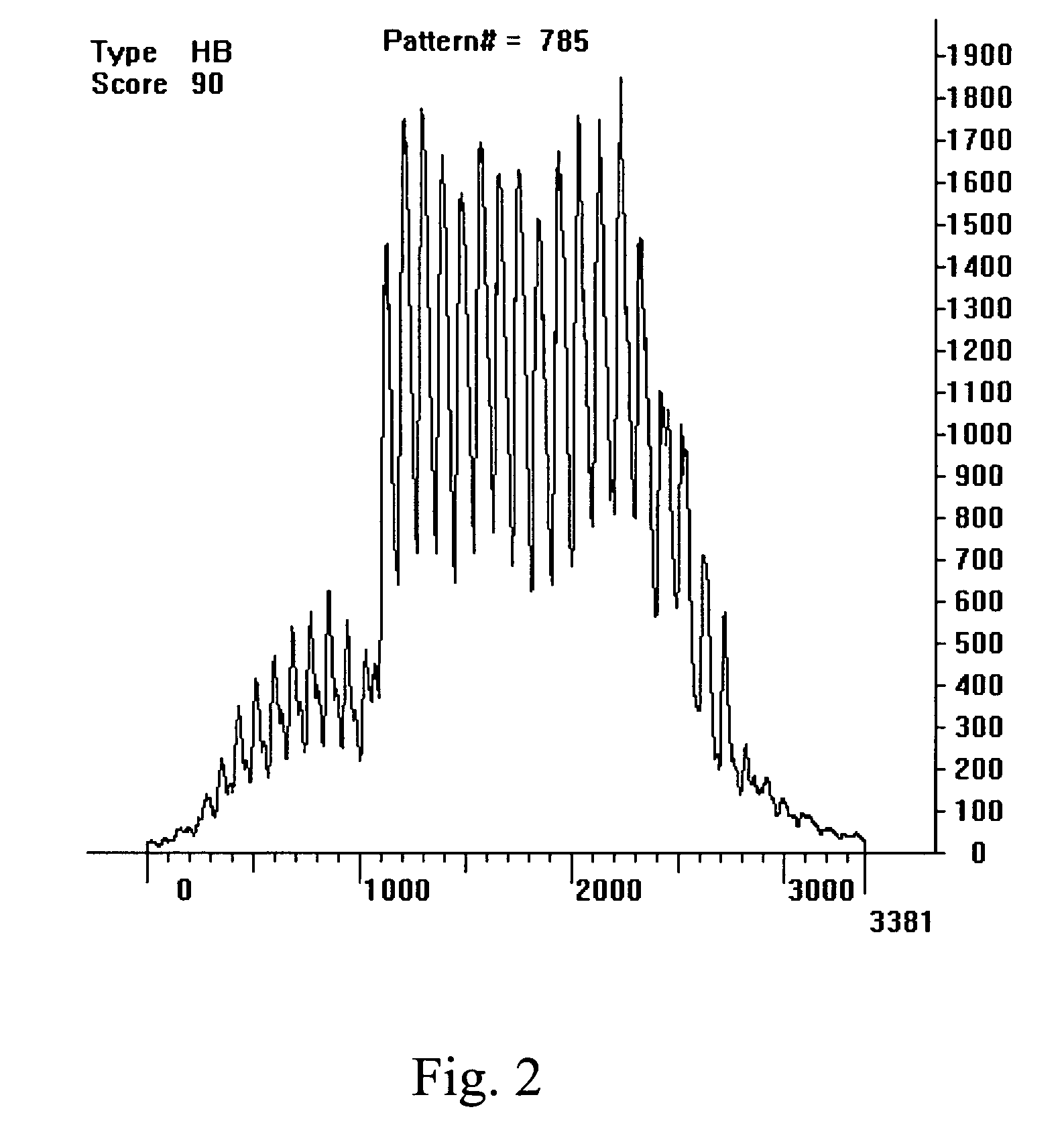 Quantifying psychological stress levels using voice patterns