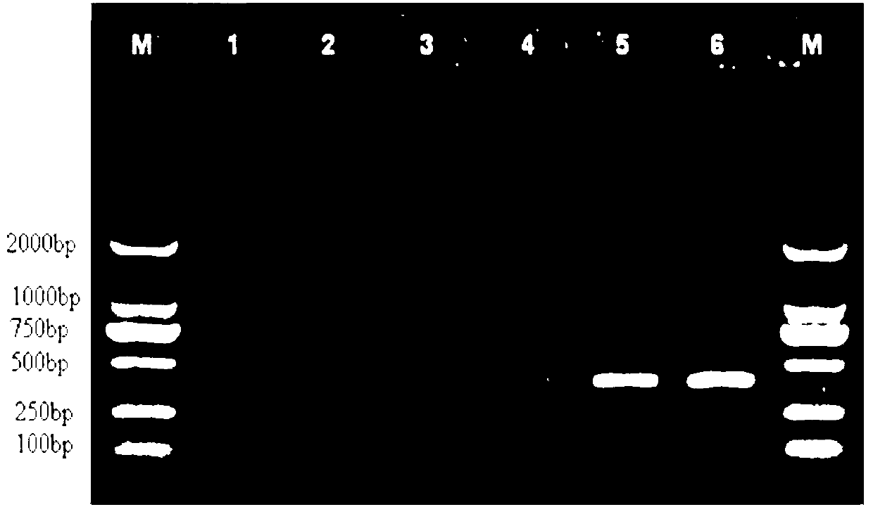 Processing method and detecting method for sample of nosema bombycis naegeli in graine by utilizing PCR (Polymerase Chain Reaction) method