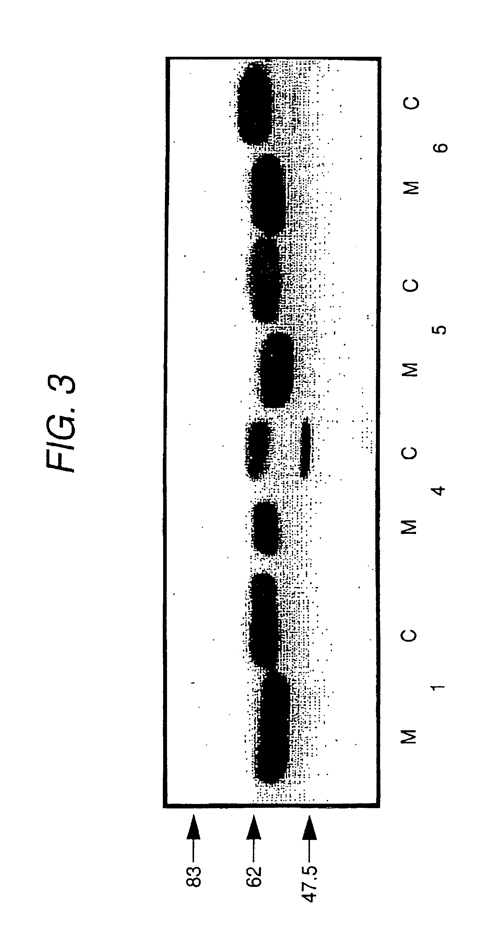 Secretory thyroid stimulating hormone receptor, and method for assaying anti-thyroid stimulating hormone receptor antibody using the same