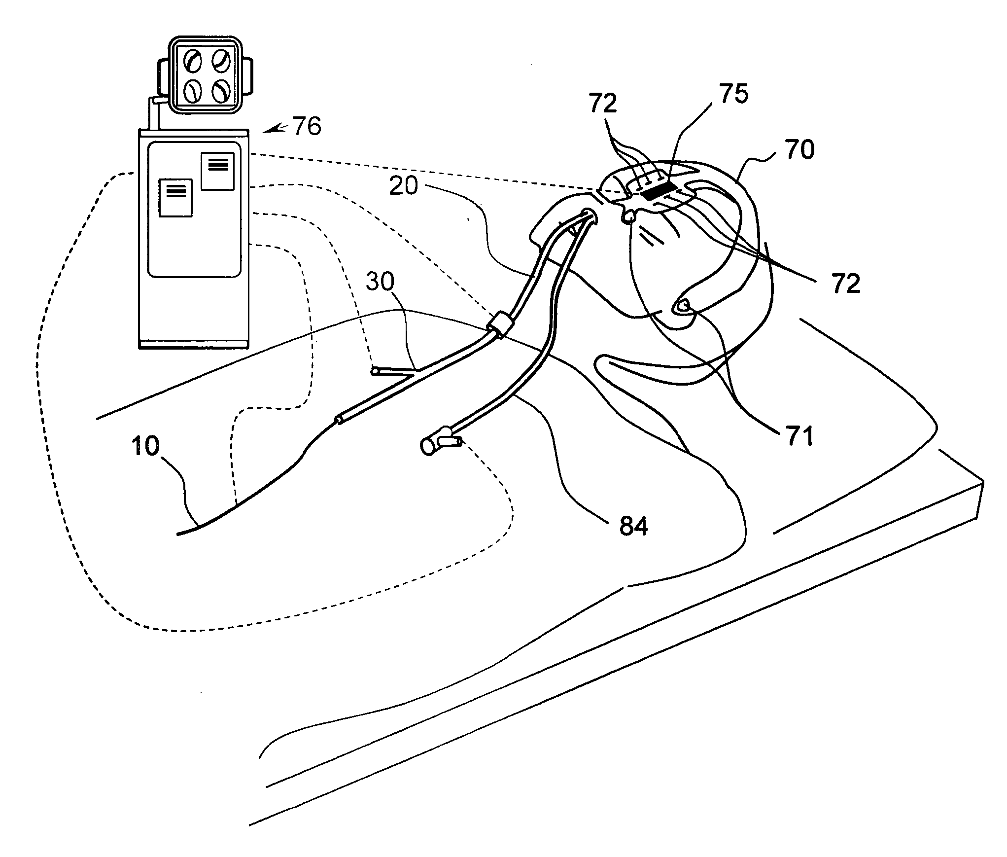 Systems and methods for performing image guided procedures within the ear, nose, throat and paranasal sinuses