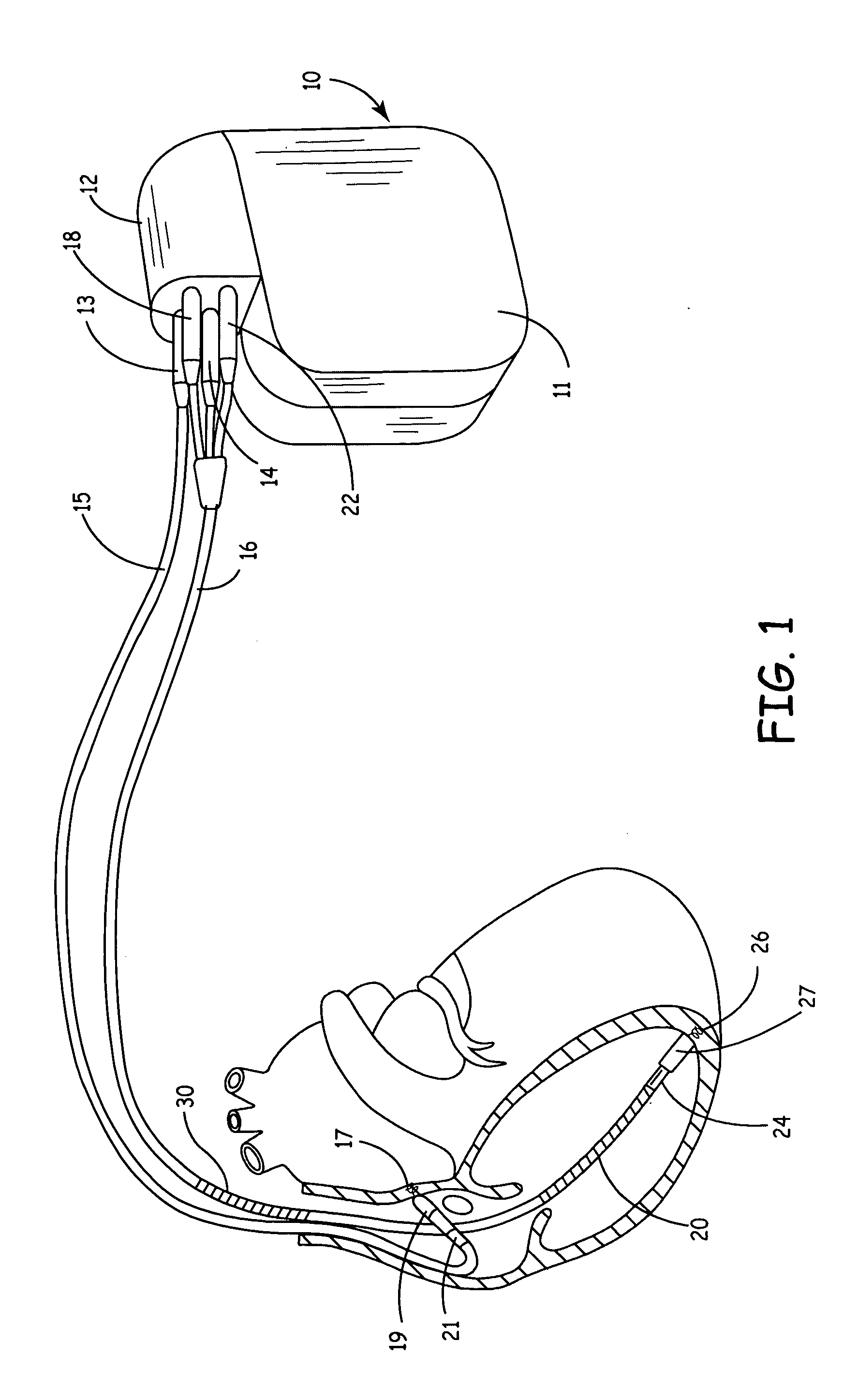 Control of arbitrary waveforms for constant delivered energy