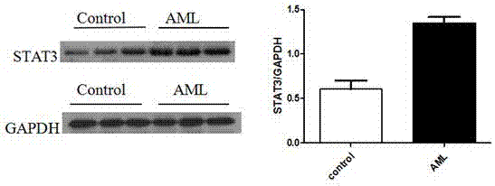 Application of ART (artesunate) as anti-leukemia-tumor drug