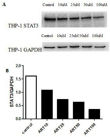 Application of ART (artesunate) as anti-leukemia-tumor drug