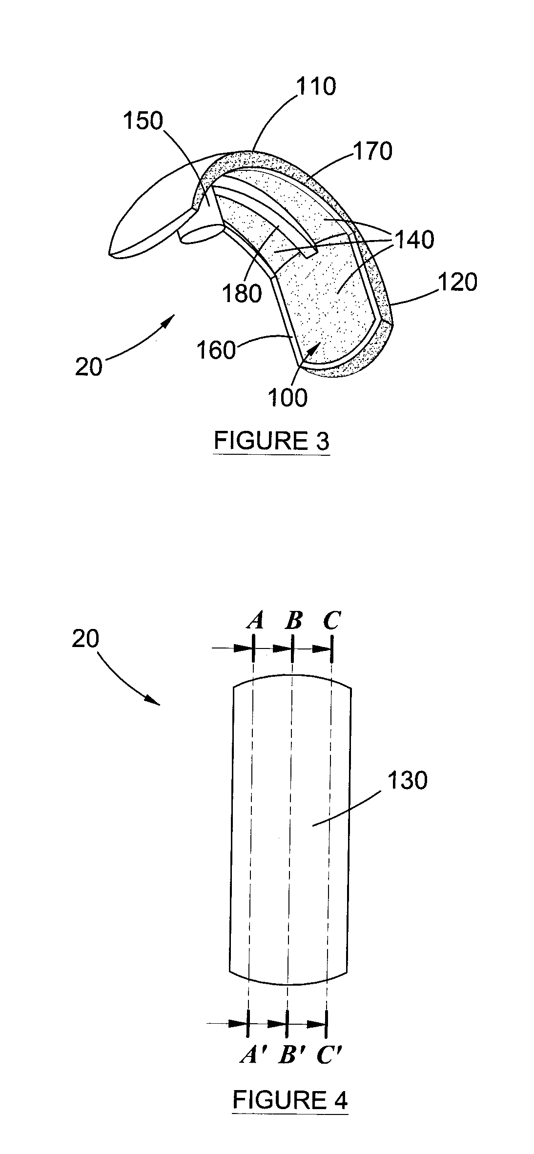 Orthopedic Prosthesis