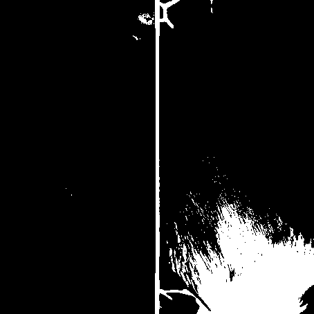 Angioma gel containing amphiphilic polymers and preparation method of angioma gel