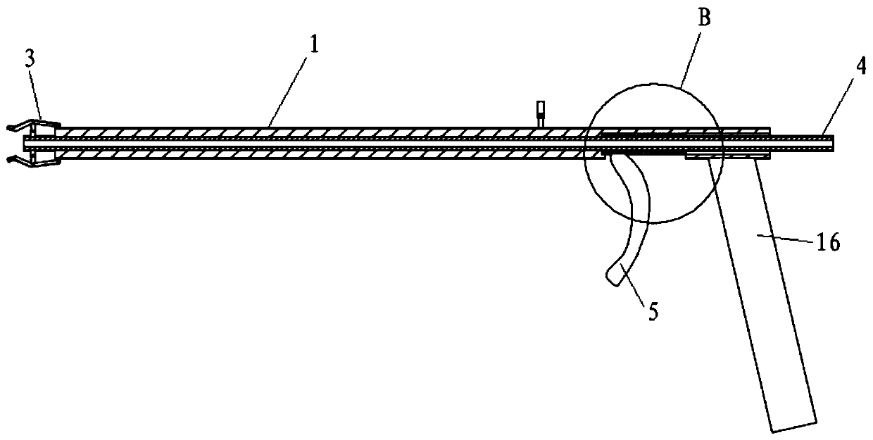 Laser lithotripsy fixing forceps