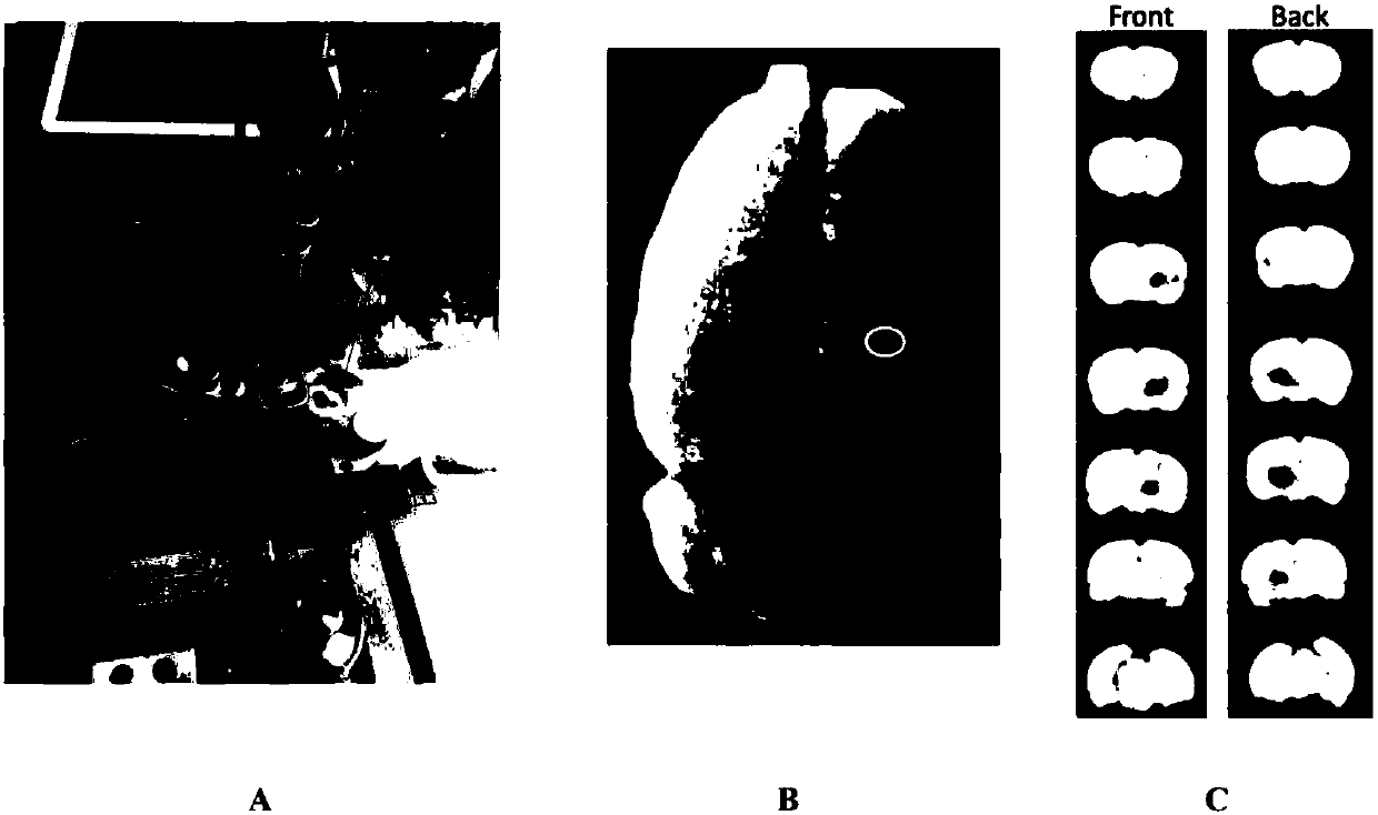 Establishment method and application of central post-stroke pain (CPSP) animal model