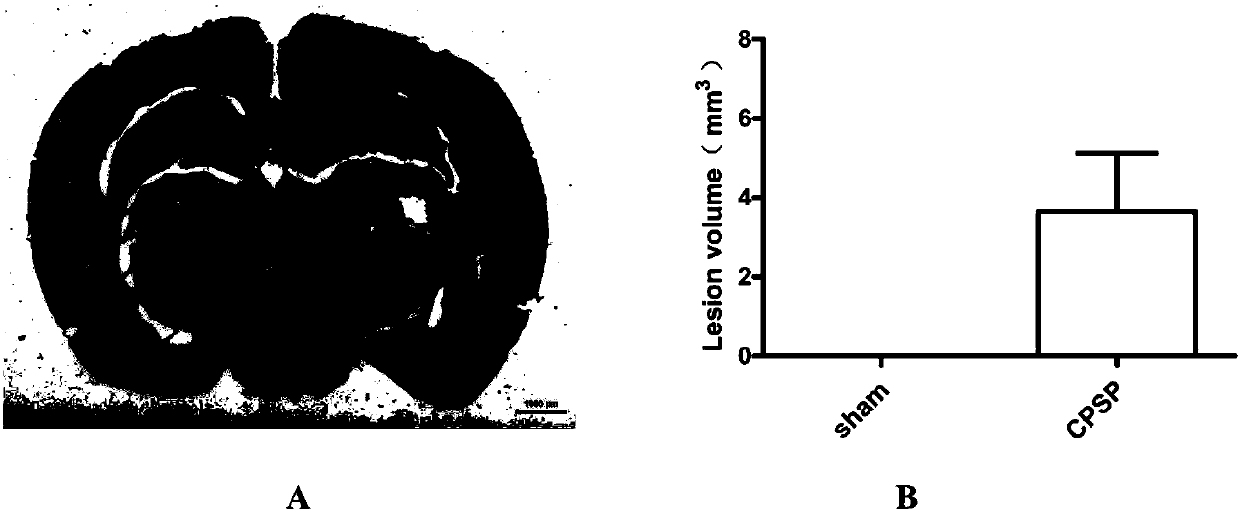 Establishment method and application of central post-stroke pain (CPSP) animal model