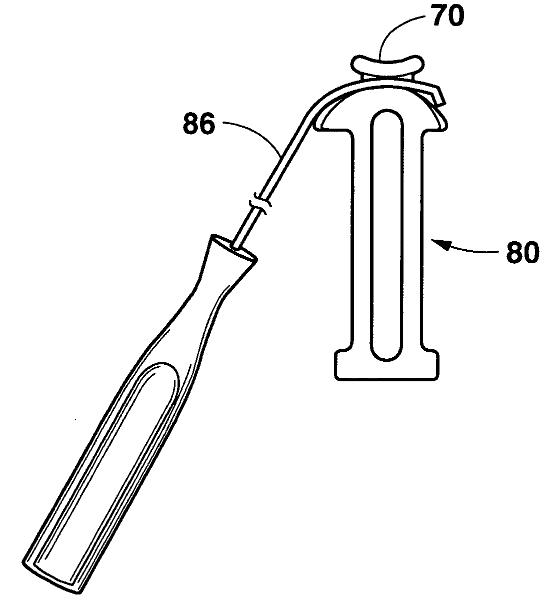 Instruments for osteolysis repair