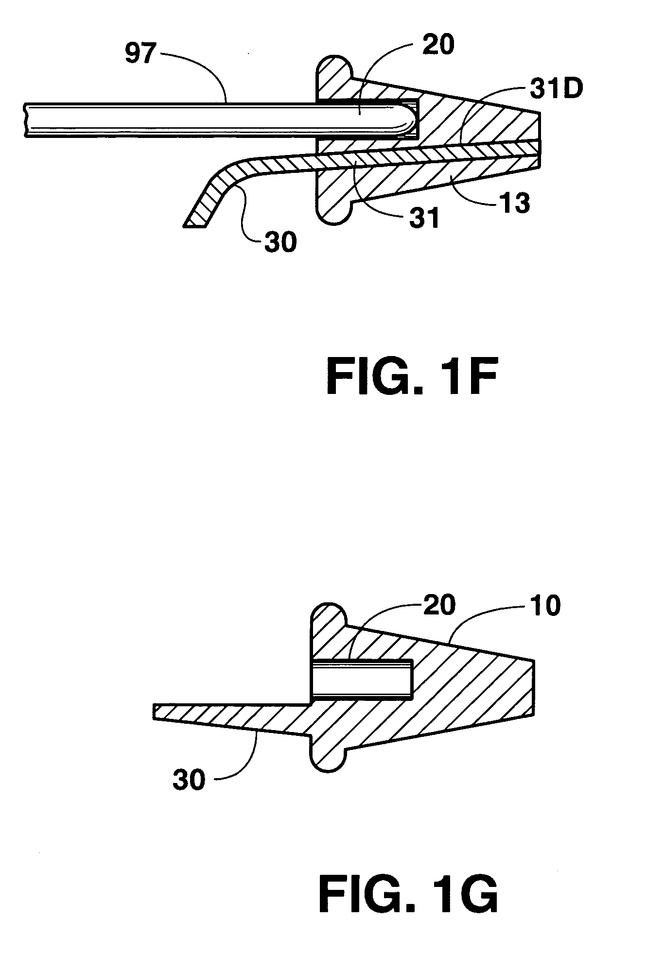 Instruments for osteolysis repair