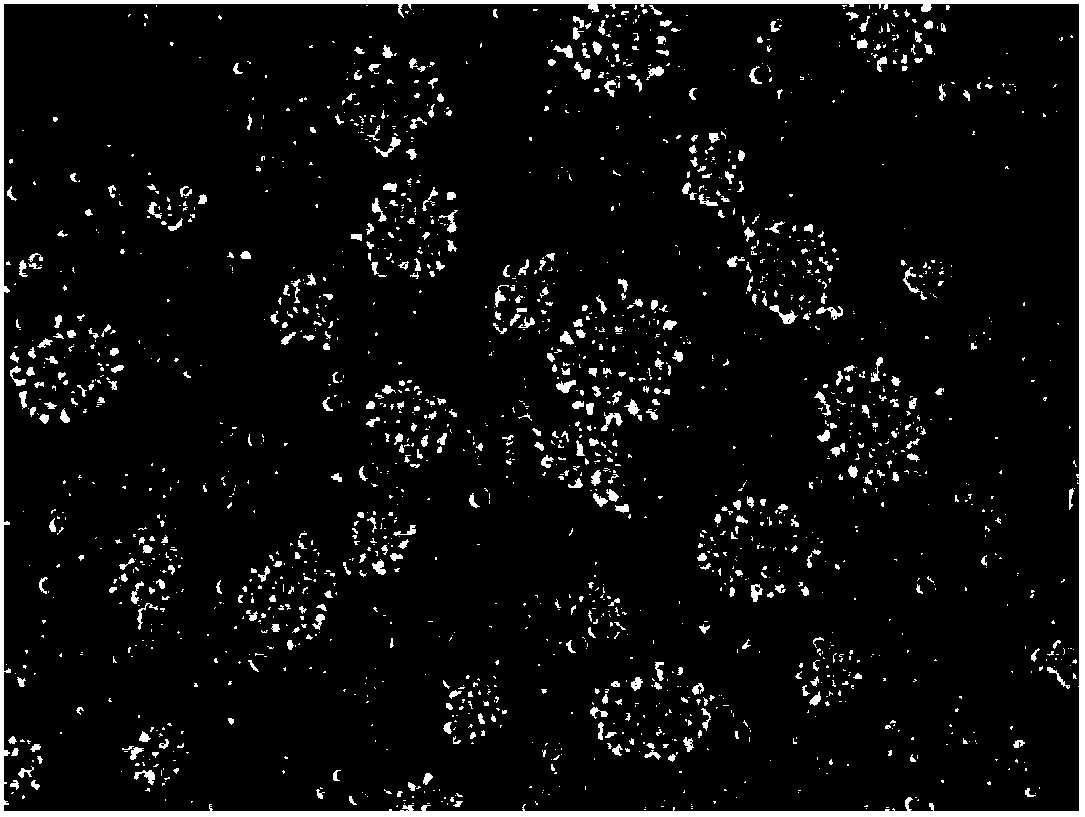 Method for in-vitro culture of killer T cells