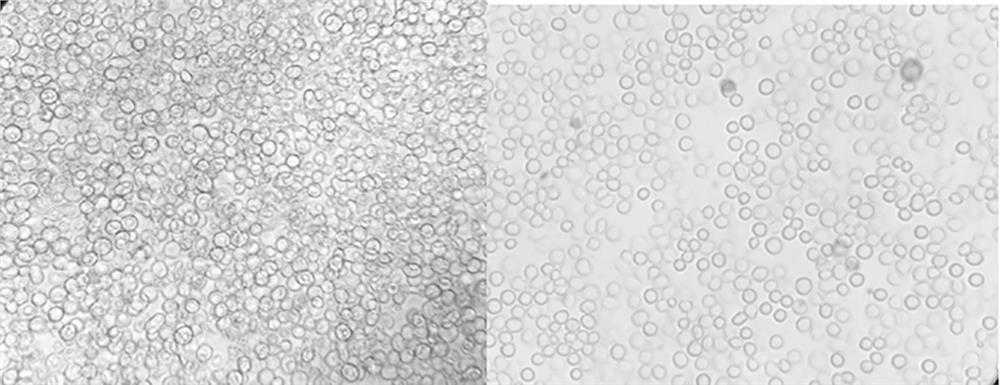 PCV2 type baculovirus and mycoplasma hyopneumoniae bivalent inactivated vaccine and preparation method thereof