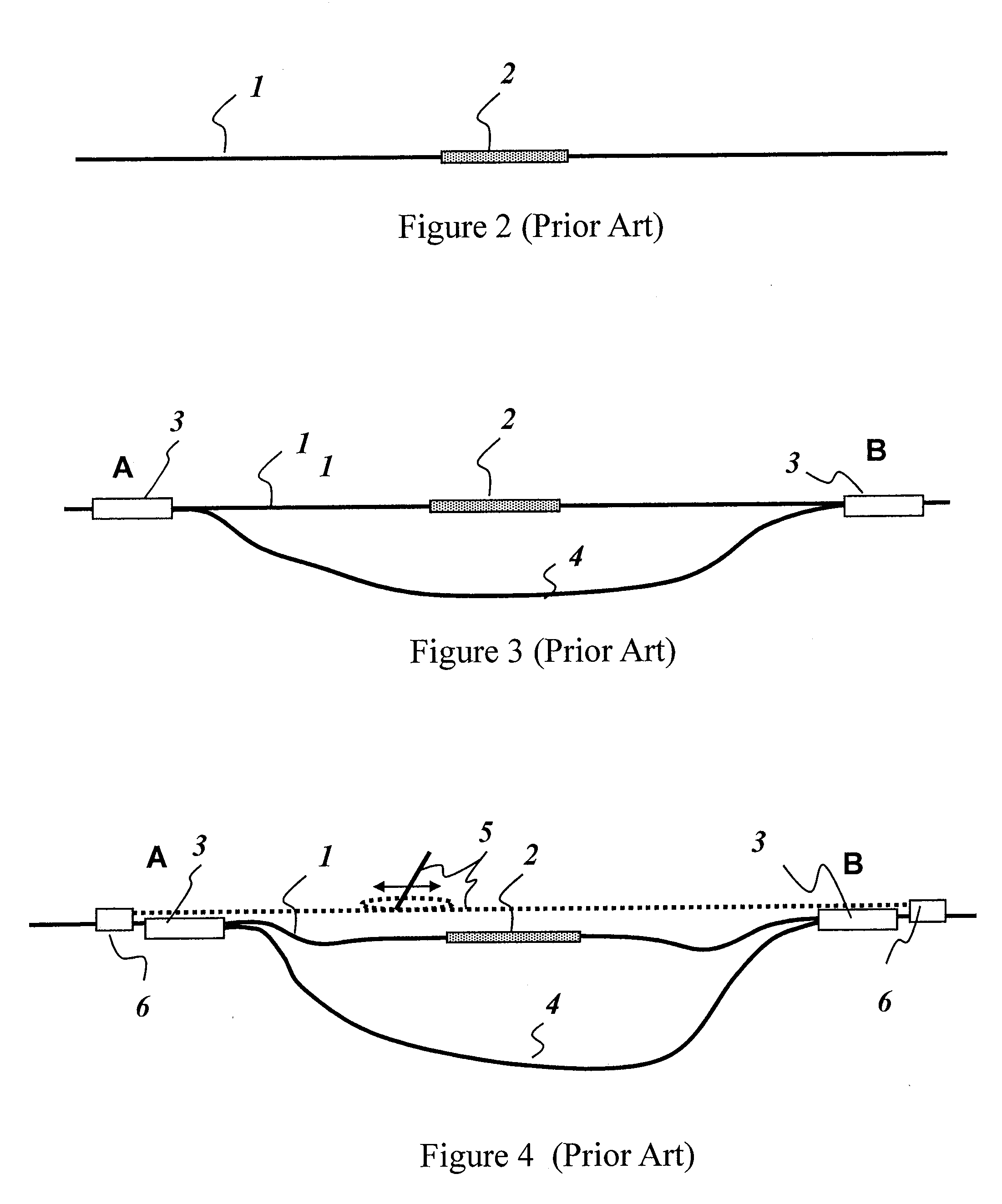 Robotic Bypass System and Method