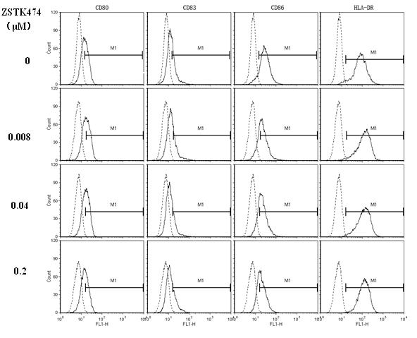 Application of ZSTK474 to preparation of medicine for treating autoimmune diseases