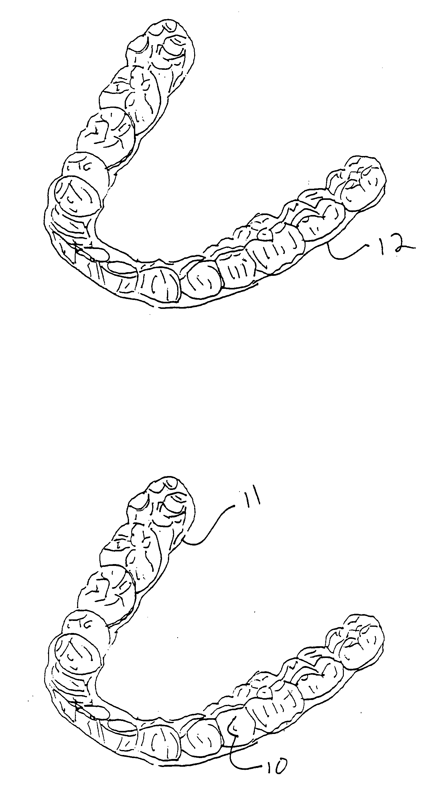 Method and system for personalized orthodontic treatment