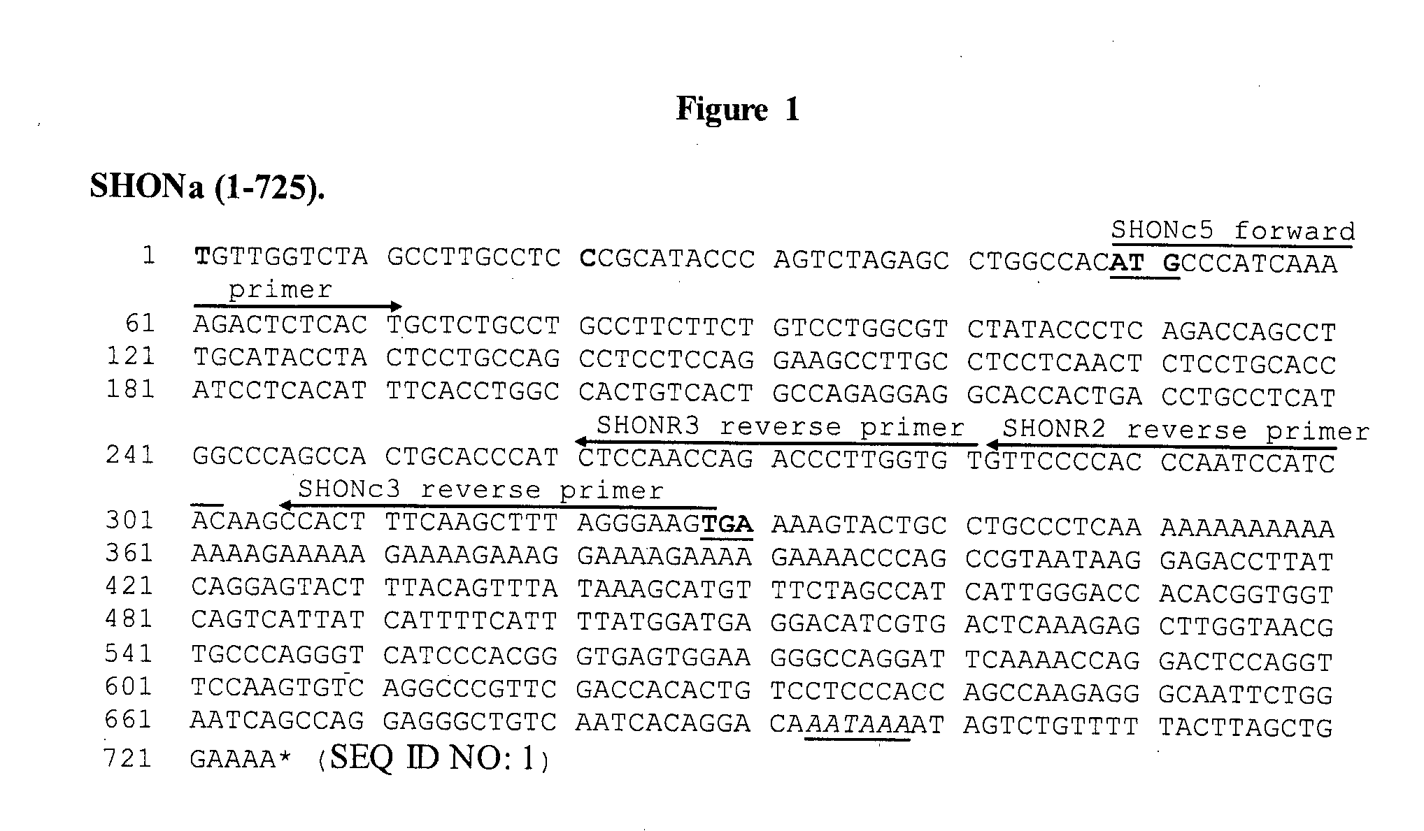 Shon as a prognostic biomarker for cancer and as a predictor of response to endocrine therapy