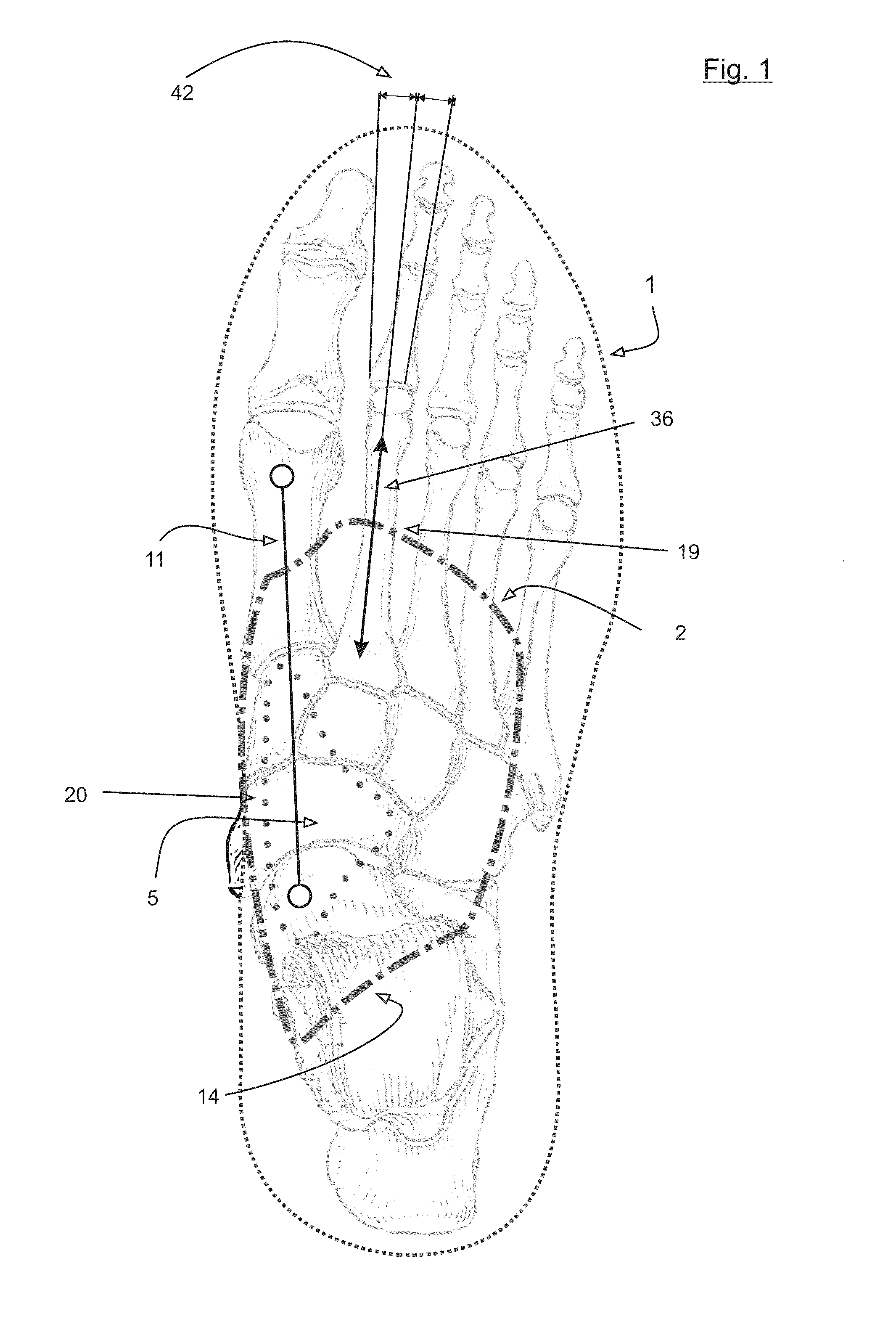 Motion control insole with muscle strengthening component