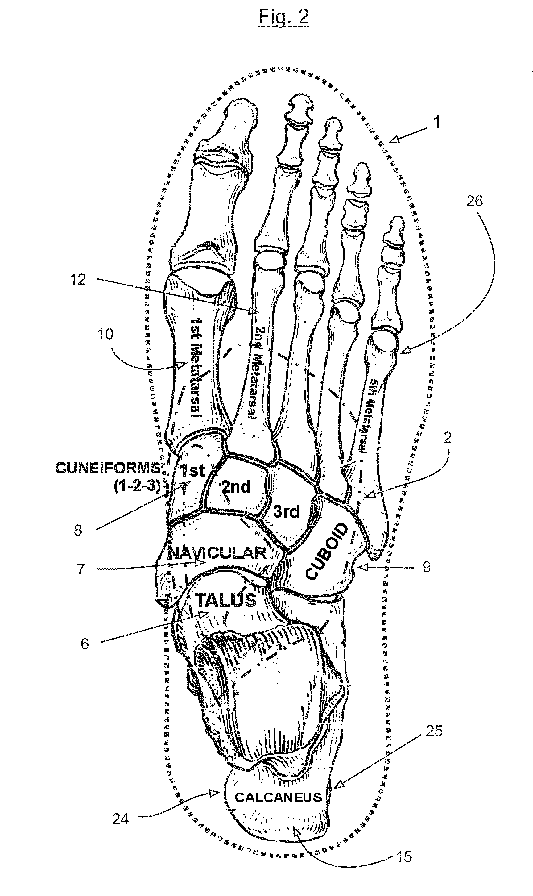 Motion control insole with muscle strengthening component