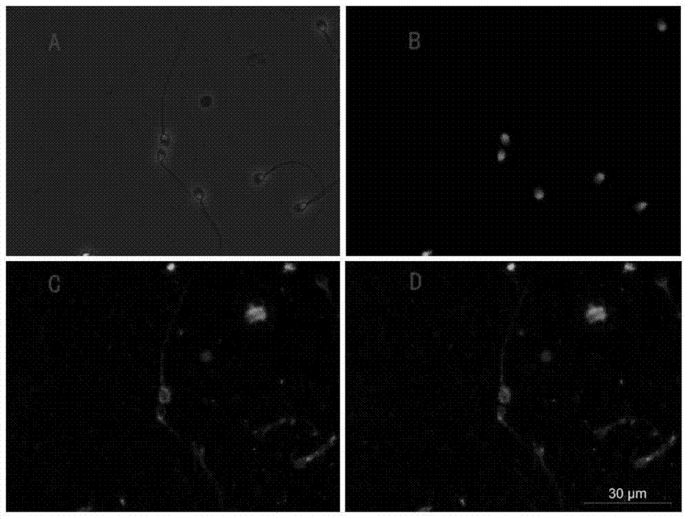 Method for separating sperm in sperm and epithelial cell mixed stain by using immunological magnetic beads