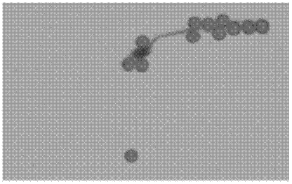 Method for separating sperm in sperm and epithelial cell mixed stain by using immunological magnetic beads