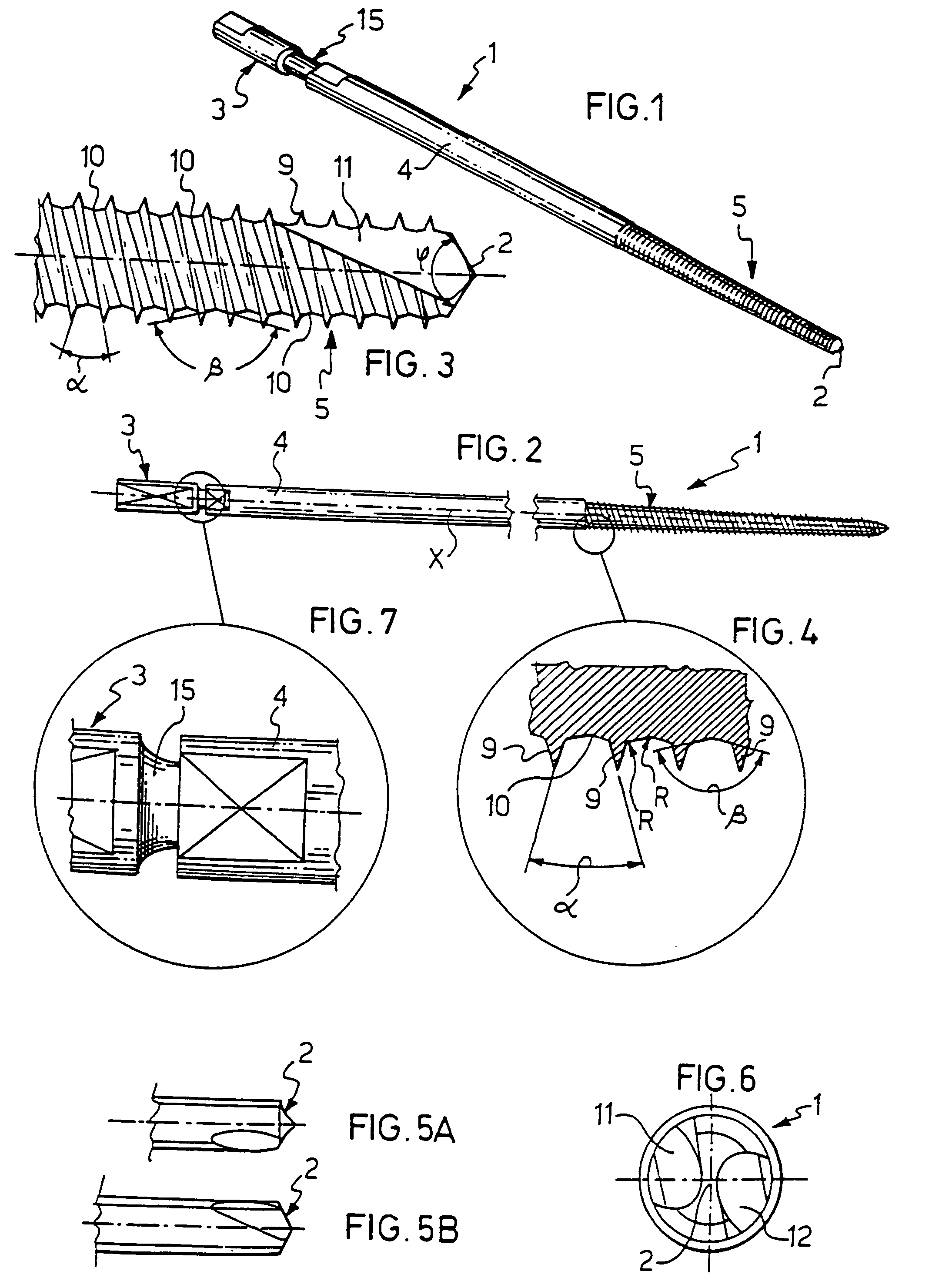 Bone screw for use in orthopaedic surgery