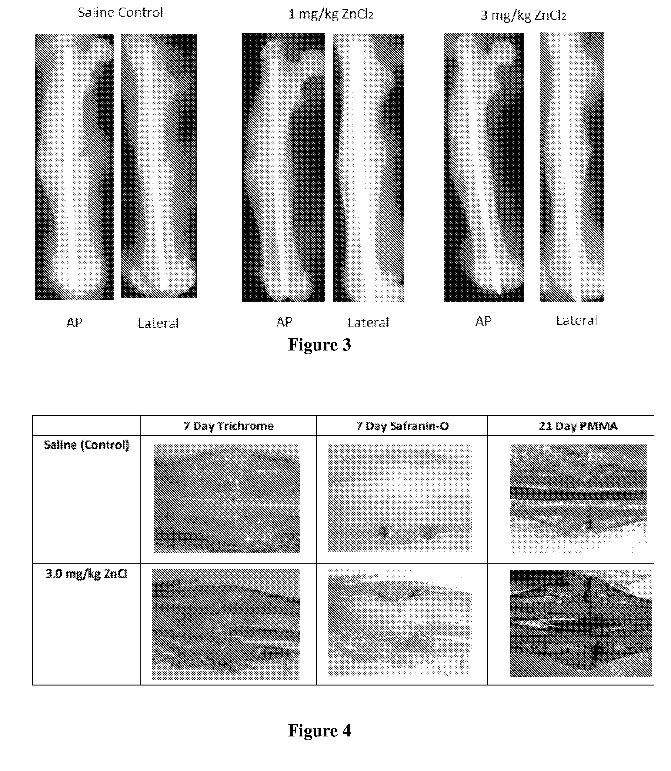 Insulin-mimetics as therapeutic adjuncts for bone regeneration