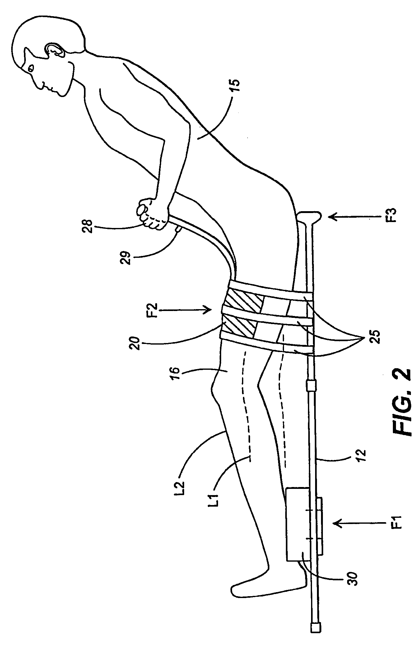 Orthotic apparatus and method for using same