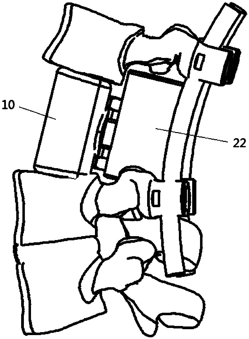 Vertebral prosthesis