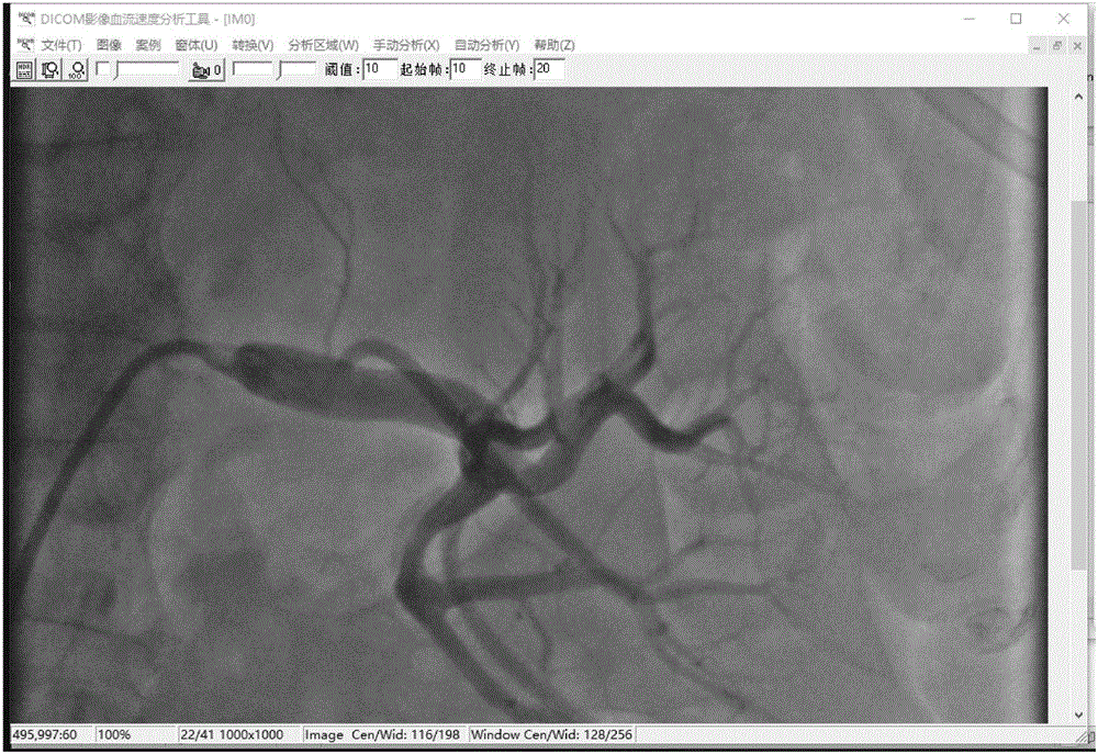 DICOM image blood flow analysis system