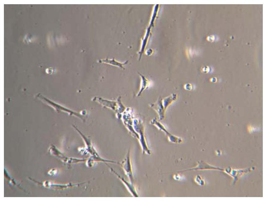 Embryonic neural stem cell in-vitro culture medium and culture method