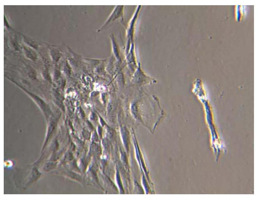 Embryonic neural stem cell in-vitro culture medium and culture method