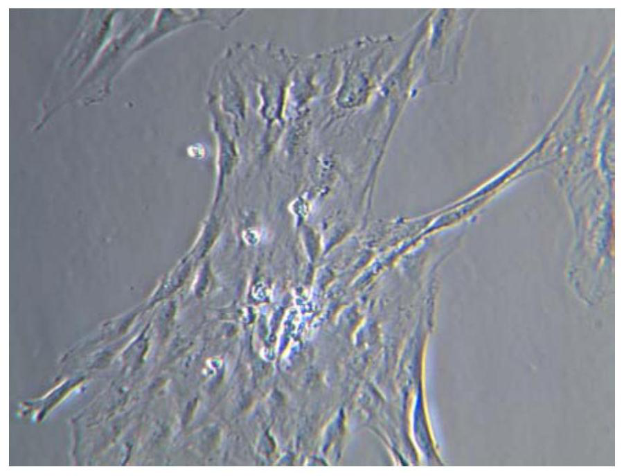 Embryonic neural stem cell in-vitro culture medium and culture method