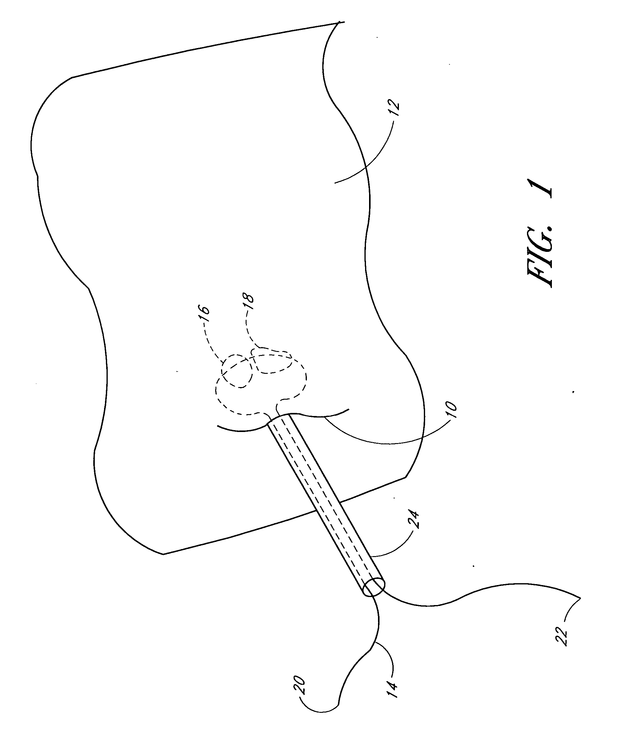 Method and apparatus for holding suture ends to facilitate tying of knots