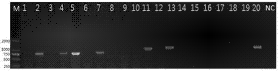 Multiple PCR (Polymerase Chain Reaction) primer groups and detection method for synchronously detecting four pathogenic bacteria of siluriformes fish