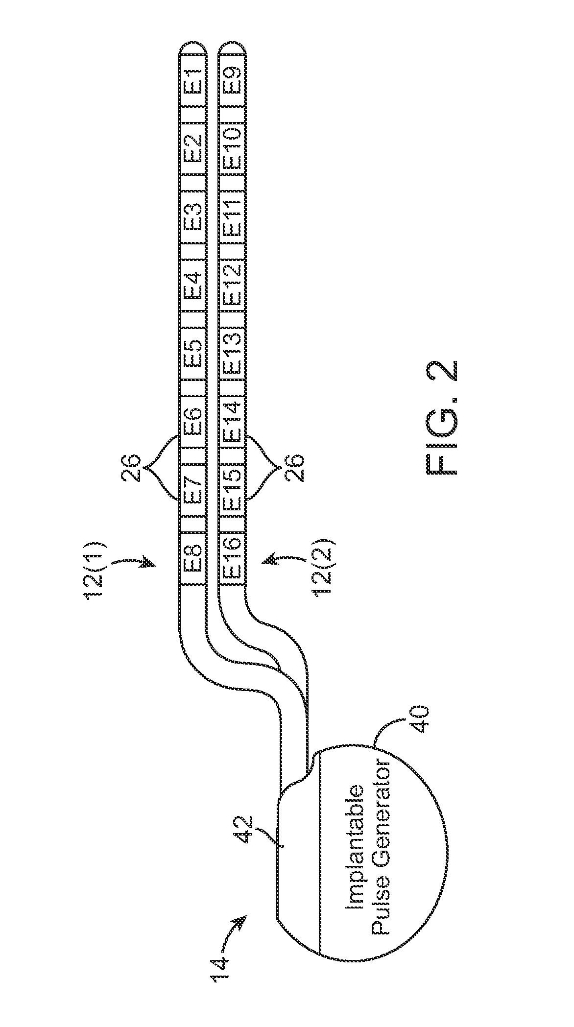 System and method for avoiding, reversing, and managing neurological accomodation to eletrical stimulation