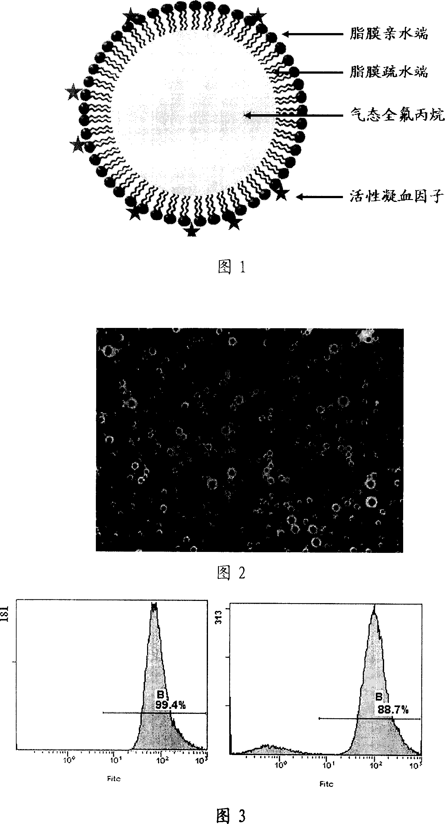 Therapeutic ultrasonic microvesicle for tumour ultrasonic therapy and its preparing method